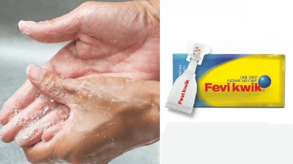 Remove Feviquick from Hand